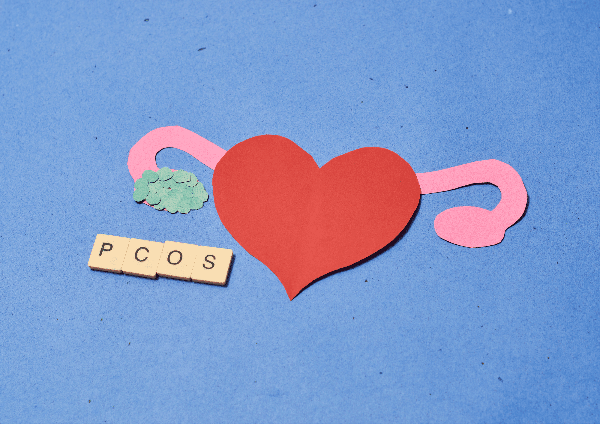 What Is PCOS Disease? 6 Essential Facts About PCOS You Need To Know To Manage Your Symptoms